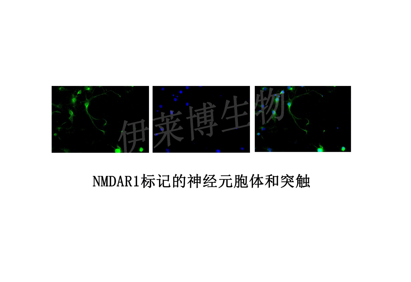 NMDAR1標記的神經(jīng)元胞體和突觸.jpg